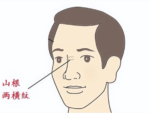 鼻梁纹代表什么意思(面相)