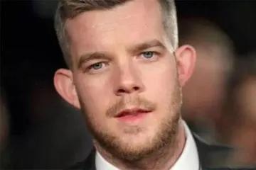 招风耳的男人女人命运好不好