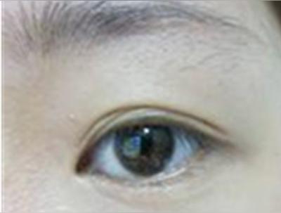 右眉毛跳是什么预兆