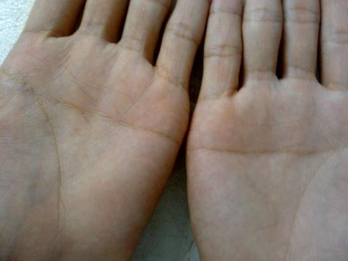 双手断掌纹有什么说法(男人 女人)