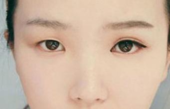 从眼睛看人的命运