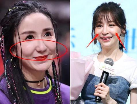 苹果肌大的女生面相