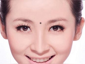 印堂痣和观音痣的区别