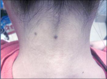 苦情痣人的命运好不好