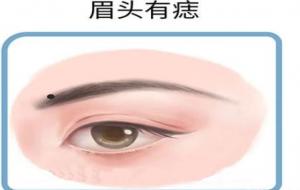 眉毛痣的位置与命运（图解）
