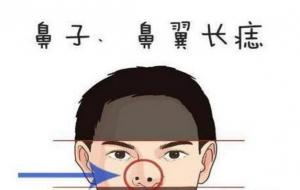 苦情痣的人一般多少岁遇到真爱