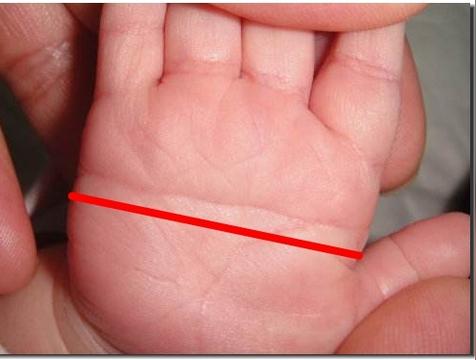 通贯手有什么特别之处（命运好不好）