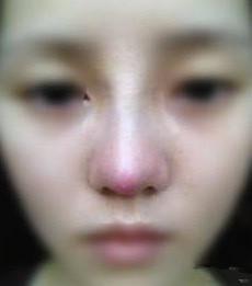 蒜头鼻女人什么命运（面相好吗）