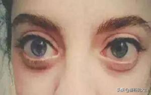 金鱼眼的人什么面相