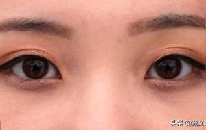 一单一双眼皮的面相命运