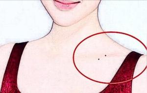 肩膀上长有痣的人命运好吗