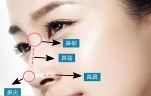 山根横纹男人面相